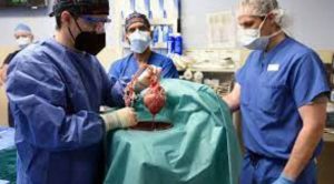 Pig heart transplant in human for the first time in US